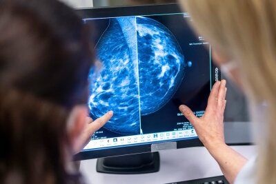 Rente, Cannabis, Getränkedeckel: Das ändert sich im Juli - Die Altersobergrenze der kostenlosen Brustkrebsvorsorge wird auf 75 Jahre angehoben.