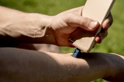 Was bei Wespen- und Mückenstichen hilft - Mit Hitze gegen den Juckreiz: Stichheiler erreichen Temperaturen bis zu 50 Grad. Und die gibt es sogar fürs Smartphone.